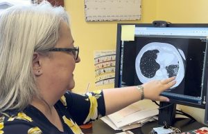 Klinik asbes Montana berupaya mengembalikan denda sebesar $6 juta, hukuman atas klaim palsu